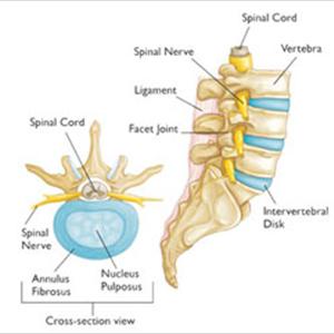 Sciatica Back Pain Relief - Sciatica Nerve Relief - The Best Ways To Get Them